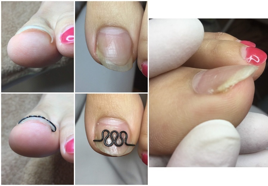 深く斜めに切っていました Coubic