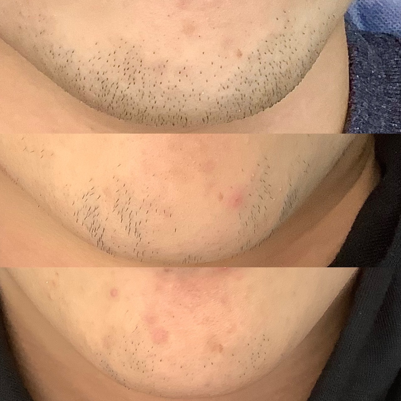 脱毛のご予約はこちらからお願いいたします Coubic 脱毛のご予約はこちらからお願いいたします Coubic