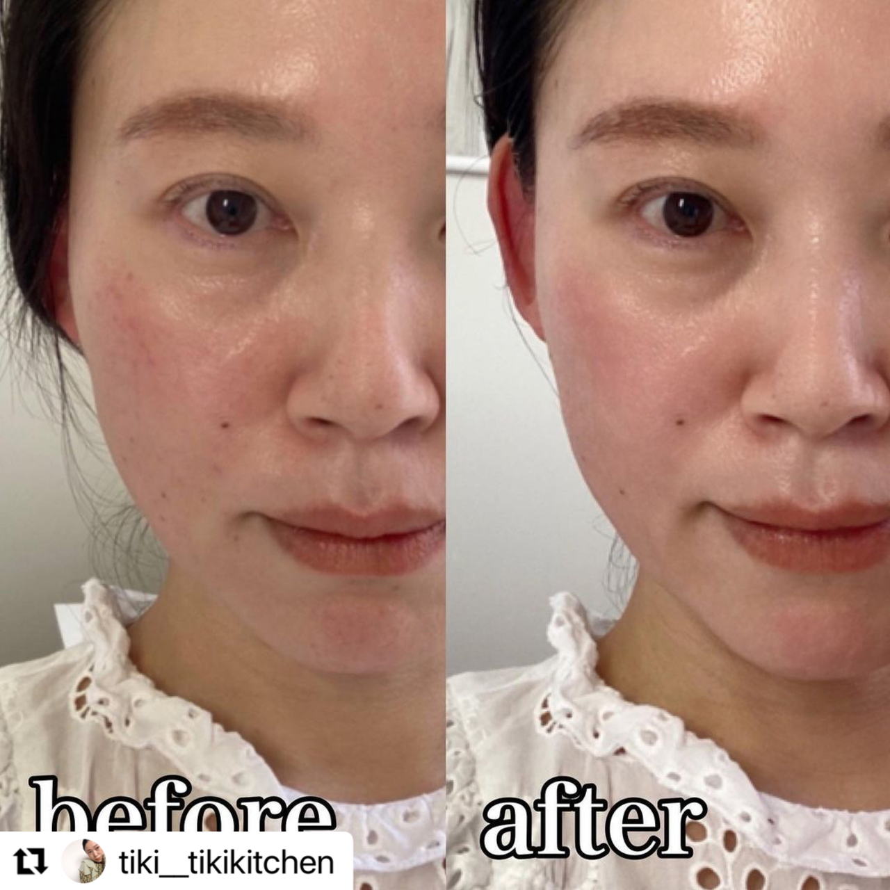 Ledの美容効果 美肌効果 Coubic