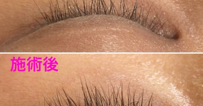 東京 港区 白金高輪 育毛マツエクの予約はこちら Coubic