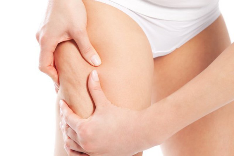 CELLULITE セルライトケア