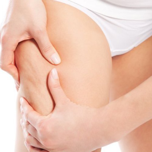 CELLULITE セルライトケア